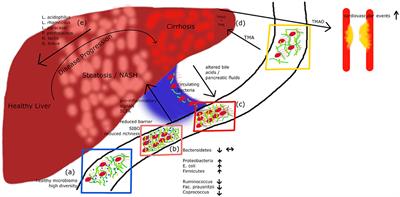 Gut Dysfunction and Non-alcoholic Fatty Liver Disease